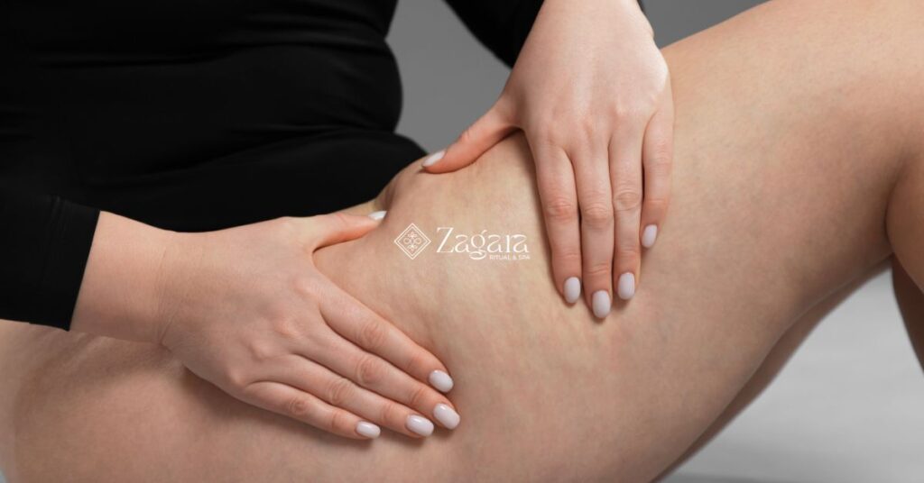 Gambe di donna su sfondo estivo — cellulite e caldo, come combatterla in estate