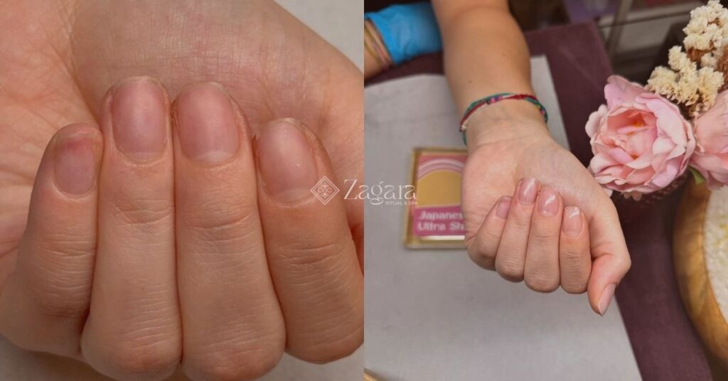 manicure curativa giapponese - Zagara spa