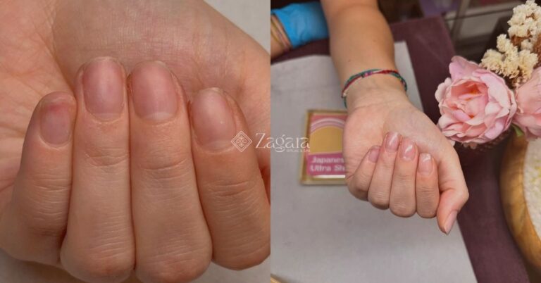 manicure curativa giapponese - Zagara spa